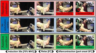 Low Gain Servo Control During the Kohnstamm Phenomenon Reveals Dissociation Between Low-Level Control Mechanisms for Involuntary vs. Voluntary Arm Movements